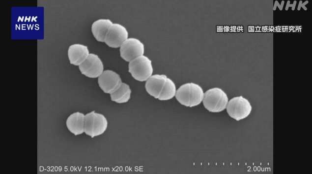 日本链球菌中毒性休克综合征报告激增 30岁以上人群发病率高